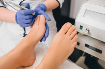 Best-toenail-fungus-treatment-laser-nail-therapy