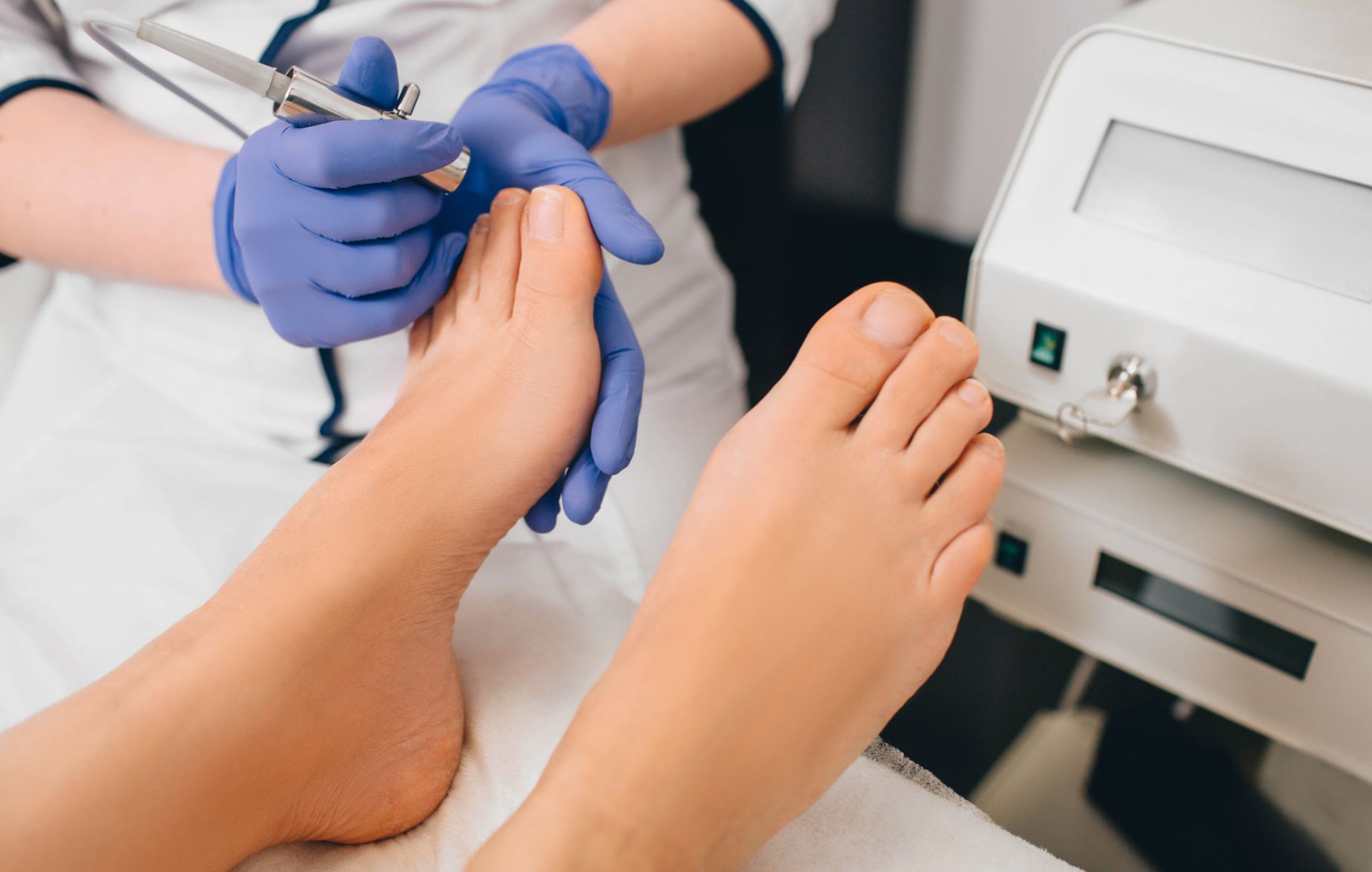 best-toenail-fungus-treatment-laser-nail-therapy